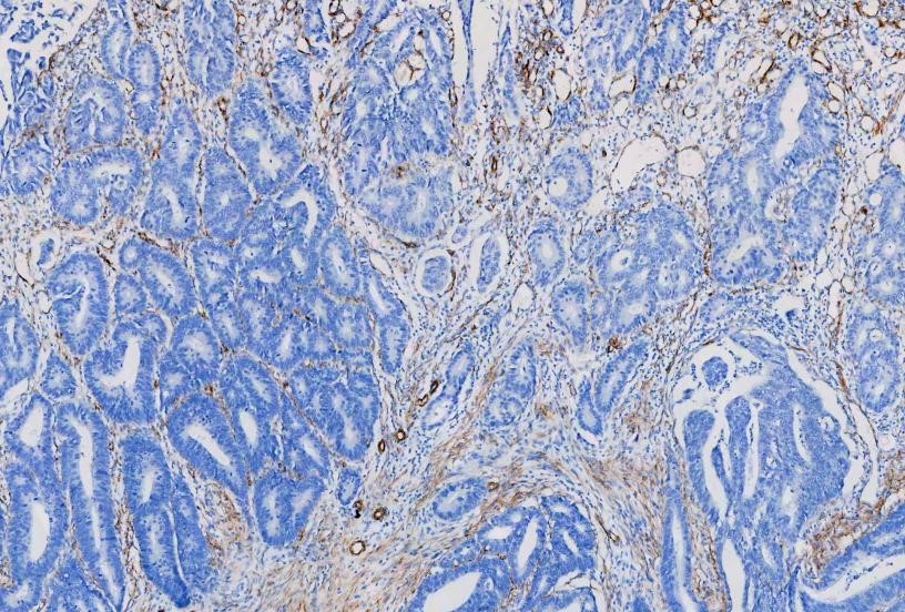 Antigen Retrieval 05